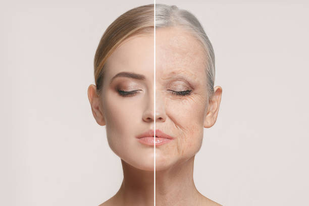 Laser Hair Remove