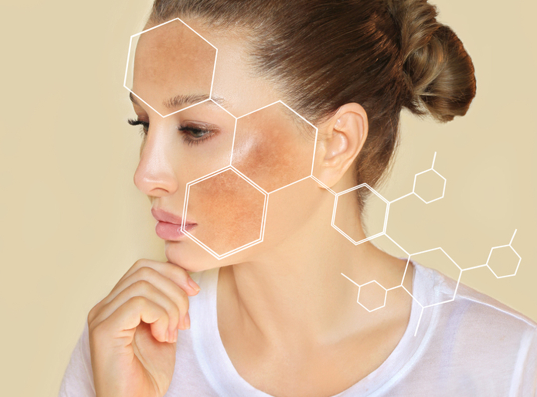 pigmentation-treatment.jpg